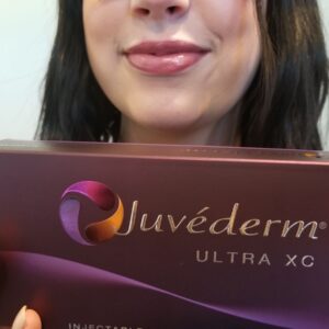 Juvederm XC